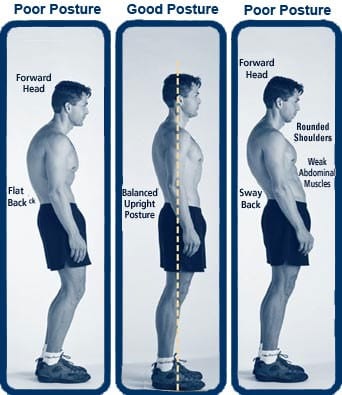 posture comparison